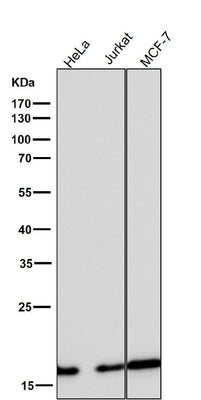 Anti-eIF5A Rabbit Monoclonal Antibody Boster Bio