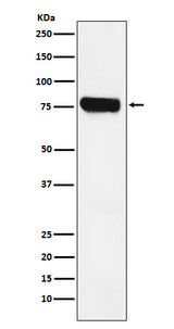 Anti-HEC1 NDC80 Monoclonal Antibody Boster Bio