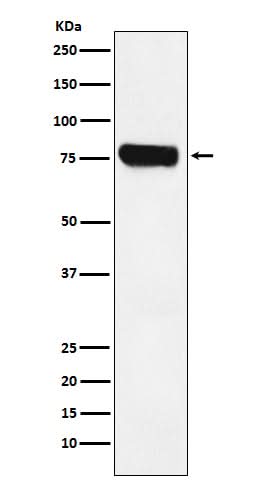 Anti-HEC1 NDC80 Monoclonal Antibody Boster Bio