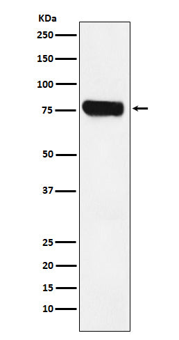 Anti-HEC1 NDC80 Monoclonal Antibody Boster Bio