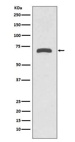 Anti-MMP8 Rabbit Monoclonal Antibody Boster Bio