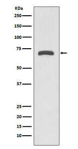 Anti-MMP8 Rabbit Monoclonal Antibody Boster Bio