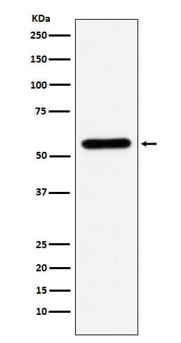 Anti-Liver Carboxylesterase 1 Monoclonal Antibody Boster Bio