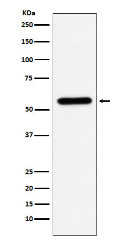 Anti-Liver Carboxylesterase 1 Monoclonal Antibody Boster Bio
