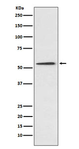 Anti-Protein C Rabbit Monoclonal Antibody Boster Bio