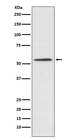 Anti-Protein C Rabbit Monoclonal Antibody Boster Bio