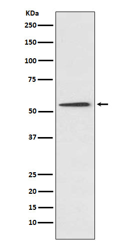 Anti-Protein C Rabbit Monoclonal Antibody Boster Bio