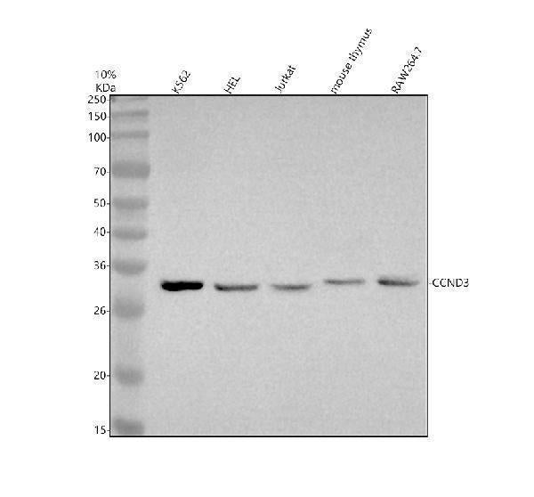 Anti-Cyclin D3 CCND3 Rabbit Monoclonal Antibody Boster Bio