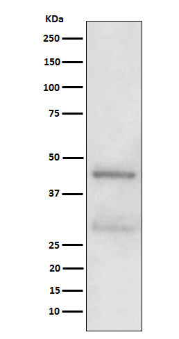 Anti-MBD2 Rabbit Monoclonal Antibody Boster Bio