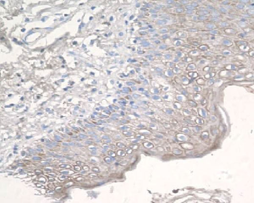 Anti-CCR3 Rabbit Monoclonal Antibody Boster Bio