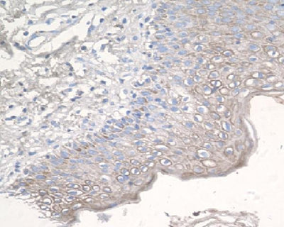 Anti-CCR3 Rabbit Monoclonal Antibody Boster Bio