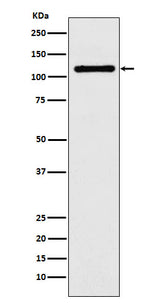 Anti-DPYD Rabbit Monoclonal Antibody Boster Bio
