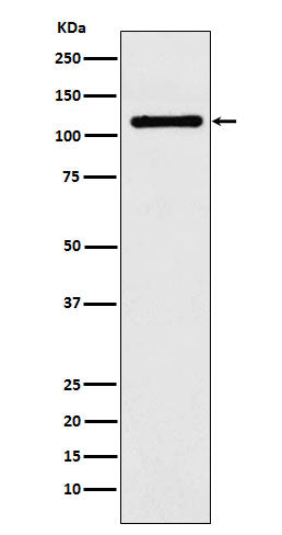 Anti-DPYD Rabbit Monoclonal Antibody Boster Bio