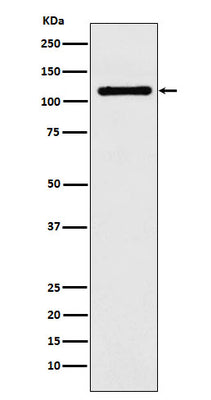 Anti-DPYD Rabbit Monoclonal Antibody Boster Bio