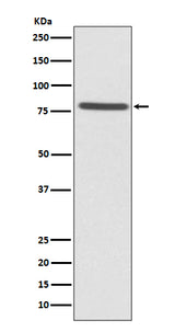 Anti-Ezrin Rabbit Monoclonal Antibody Boster Bio