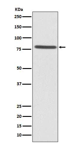 Anti-Ezrin Rabbit Monoclonal Antibody Boster Bio