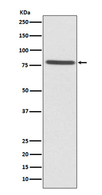 Anti-Ezrin Rabbit Monoclonal Antibody Boster Bio