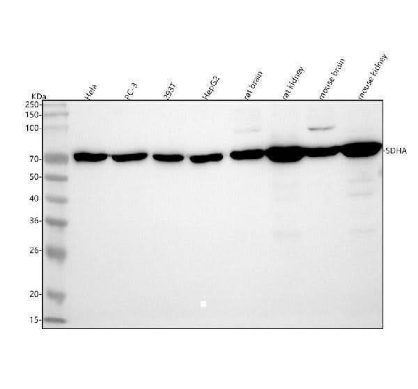 Anti-SDHA Rabbit Monoclonal Antibody Boster Bio