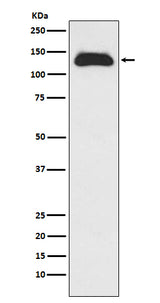 Anti-Eg5 Rabbit Monoclonal Antibody Boster Bio