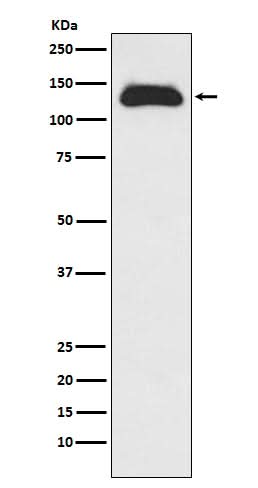 Anti-Eg5 Rabbit Monoclonal Antibody Boster Bio