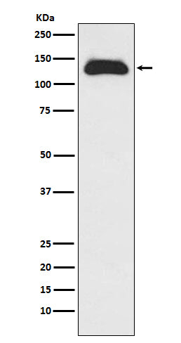 Anti-Eg5 Rabbit Monoclonal Antibody Boster Bio