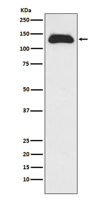 Anti-Eg5 Rabbit Monoclonal Antibody Boster Bio