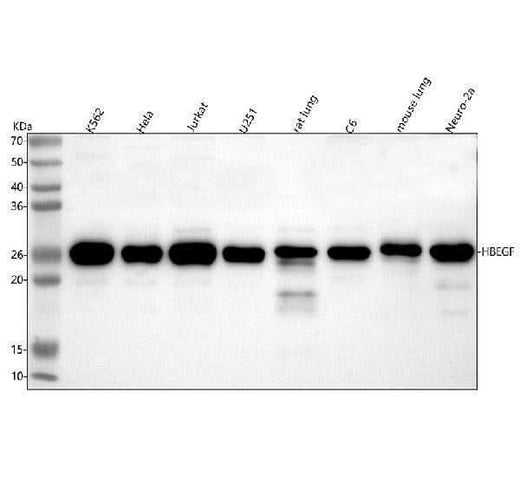Anti-HB EGF Rabbit Monoclonal Antibody Boster Bio
