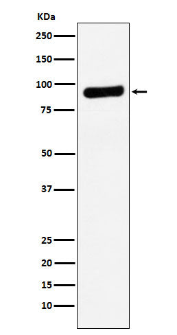 Anti-RRM1 Monoclonal Antibody Boster Bio