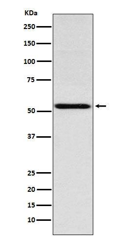 Anti-THRA Rabbit Monoclonal Antibody Boster Bio