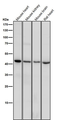 Anti-CD83 Rabbit Monoclonal Antibody Boster Bio