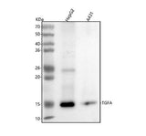 Anti-TGF alpha Monoclonal Antibody Boster Bio