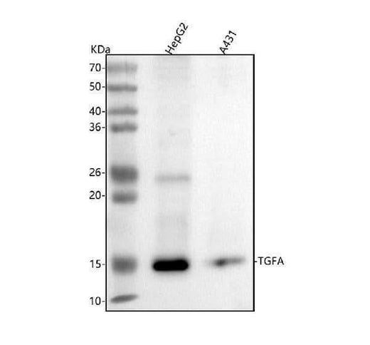 Anti-TGF alpha Monoclonal Antibody Boster Bio