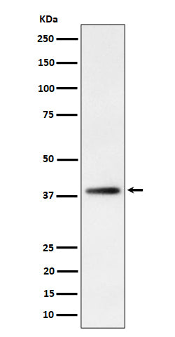 Anti-FDPS Rabbit Monoclonal Antibody Boster Bio