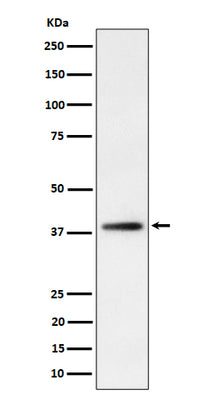 Anti-FDPS Rabbit Monoclonal Antibody Boster Bio
