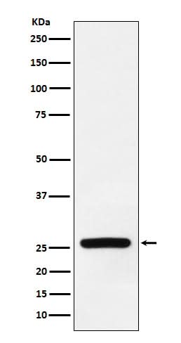 Anti-Superoxide Dismutase 3 Rabbit Monoclonal Antibody Boster Bio