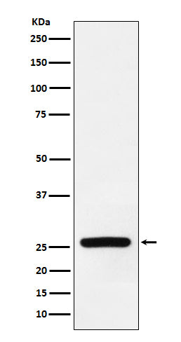 Anti-Superoxide Dismutase 3 Rabbit Monoclonal Antibody Boster Bio