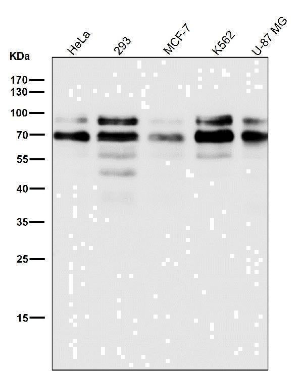 Anti-TFE3 Monoclonal Antibody Boster Bio