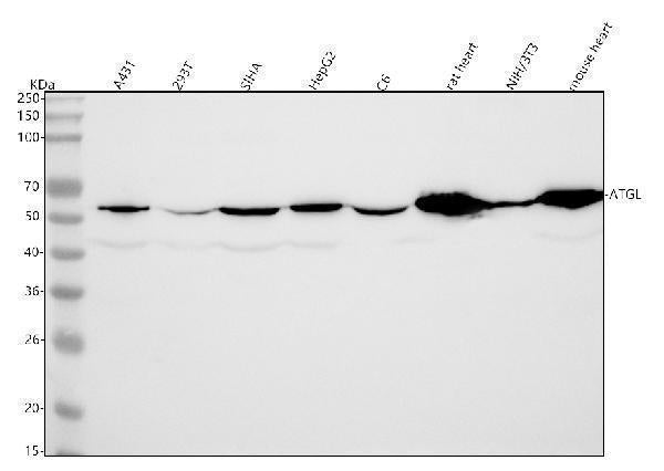 Anti-ATGL / PNPLA2 Rabbit Monoclonal Antibody Boster Bio