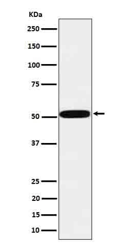 Anti-htrA1 Rabbit Monoclonal Antibody Boster Bio