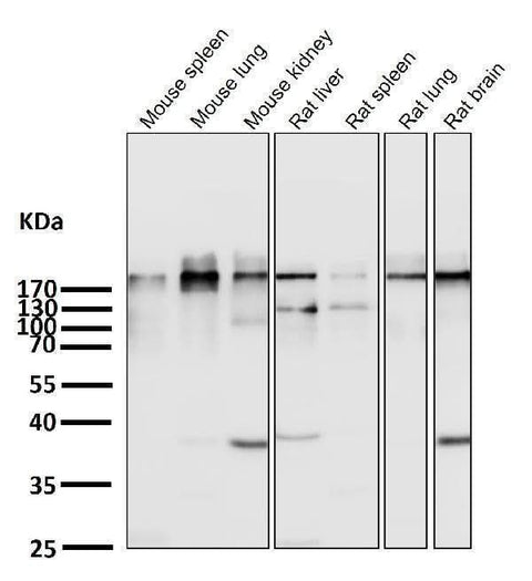 Anti-Acetyl-CoA Carboxylase Monoclonal Antibody Boster Bio