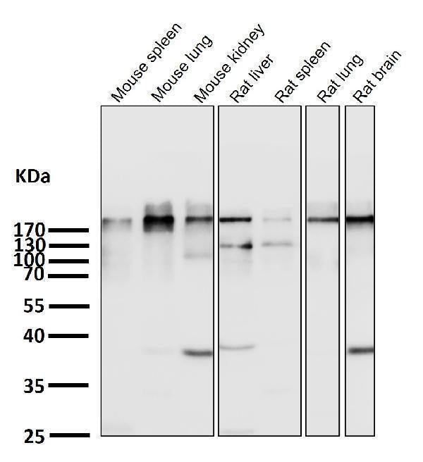 Anti-Acetyl-CoA Carboxylase Monoclonal Antibody Boster Bio