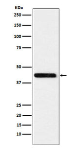 Anti-Cystathionase Rabbit Monoclonal Antibody Boster Bio