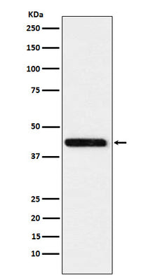 Anti-Cystathionase Rabbit Monoclonal Antibody Boster Bio