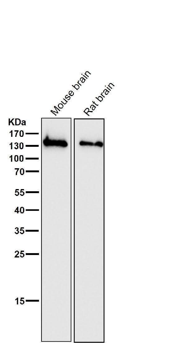 Anti-NMDAR1 GRIN1 Rabbit Monoclonal Antibody Boster Bio