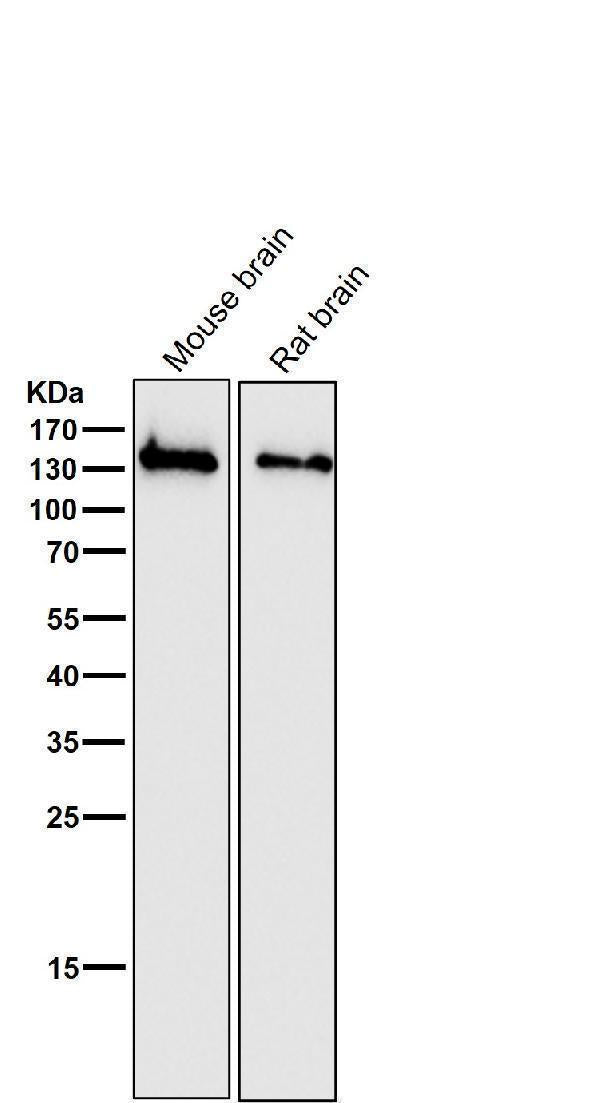 Anti-NMDAR1 GRIN1 Rabbit Monoclonal Antibody Boster Bio