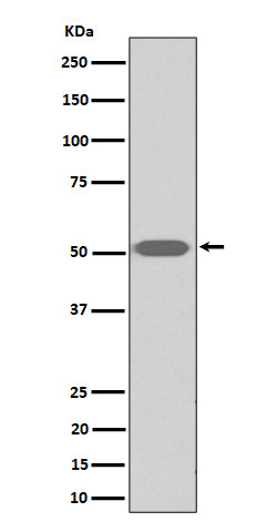 Anti-Thromboxane A2 receptor Rabbit Monoclonal Antibody Boster Bio