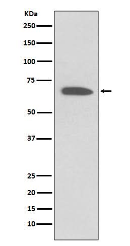 Anti-KCNA1/Kv1.1 Rabbit Monoclonal Antibody Boster Bio