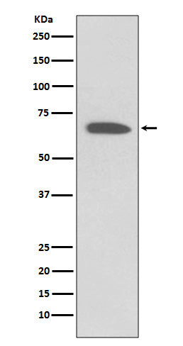 Anti-KCNA1/Kv1.1 Rabbit Monoclonal Antibody Boster Bio
