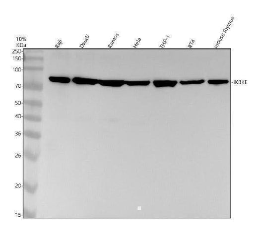 Anti-IKBKE Monoclonal Antibody Boster Bio