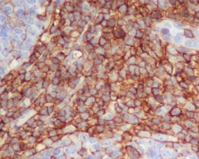 Anti-CD90 / Thy1 Rabbit Monoclonal Antibody Boster Bio